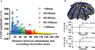 Localization of Epileptogenic Zone Based on Cortico-Cortical Evoked Potential (CCEP): A Feature Extraction and Graph Theory Approach